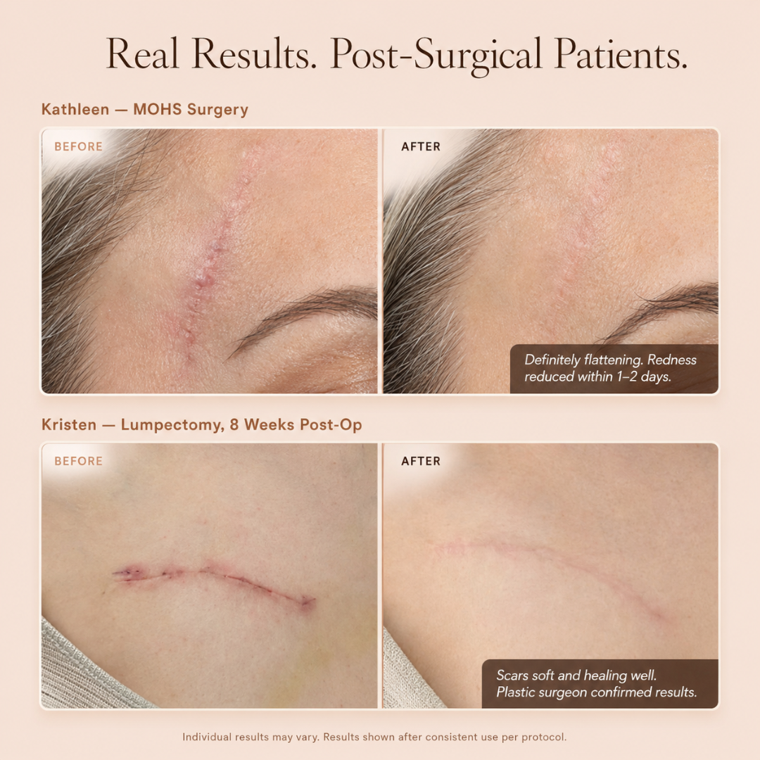 Curelle™ Scar Healing Stick