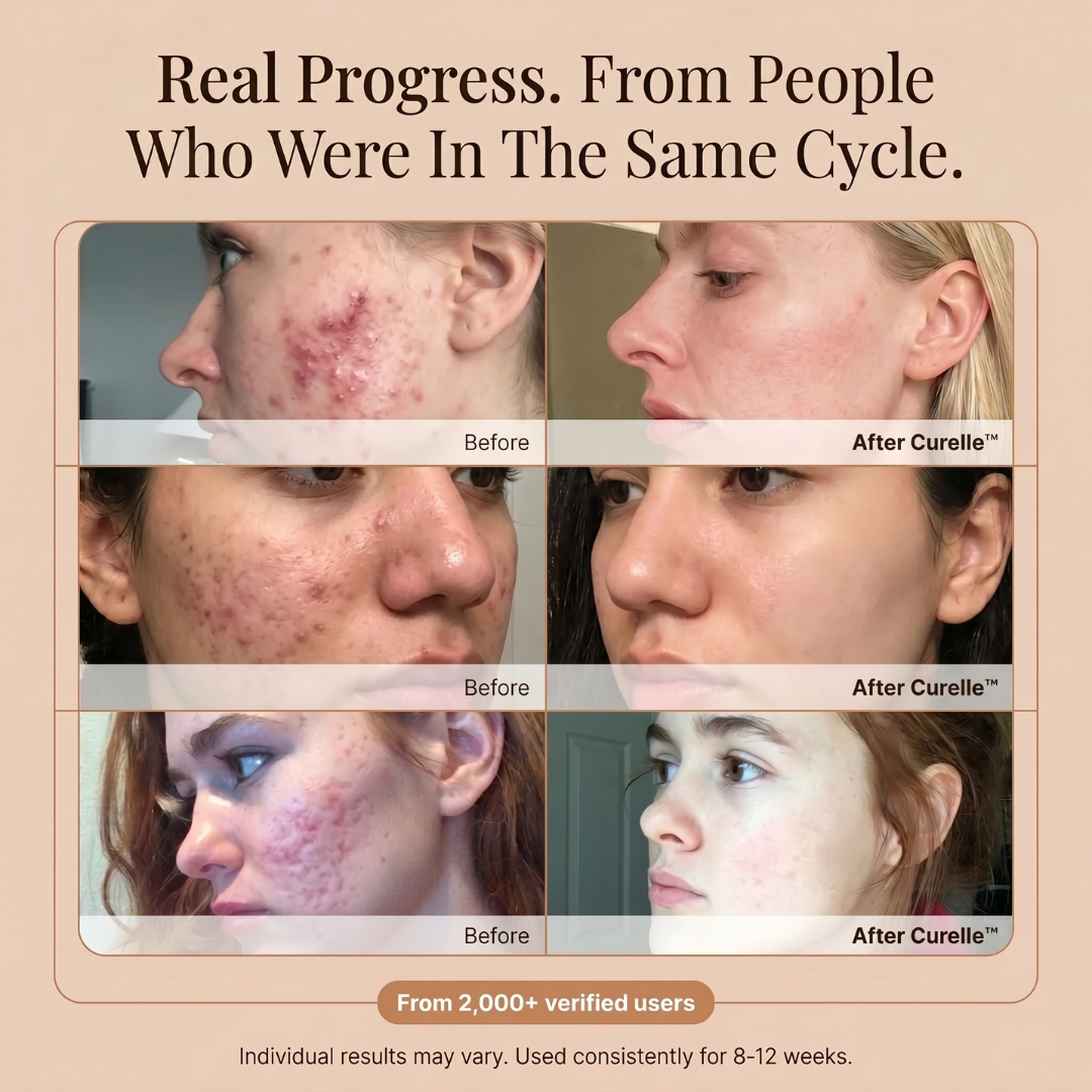 Curelle™ Scar Soothe Stick